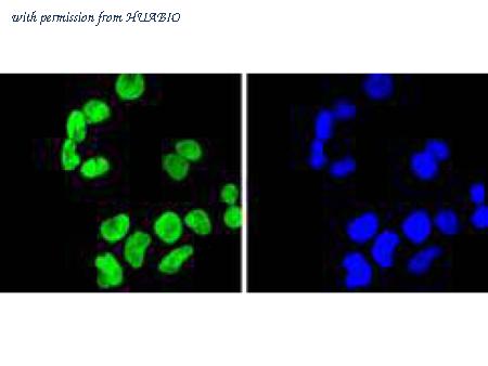 HUABIO ET1611-51 image 3