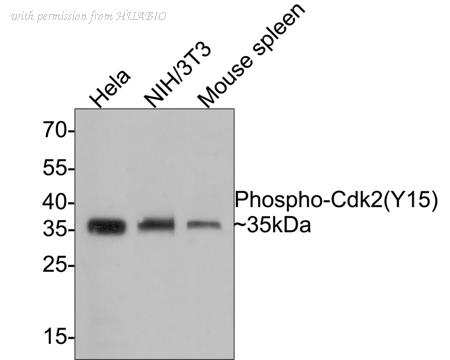 HUABIO ET1611-52 image 1