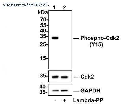 HUABIO ET1611-52 image 2