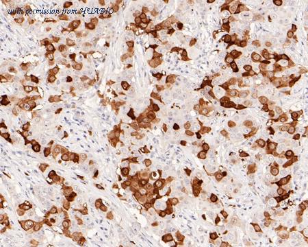 HUABIO ET1611-52 image 3