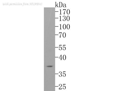 HUABIO ET1611-53 image 1