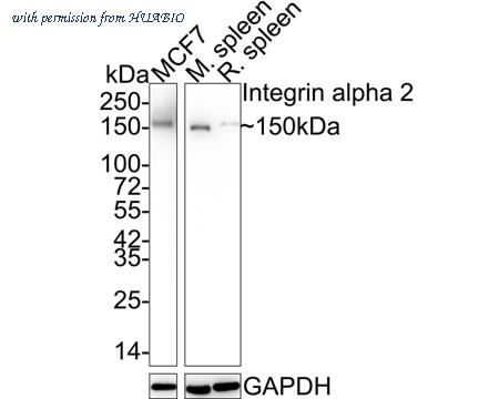 HUABIO ET1611-57 image 2