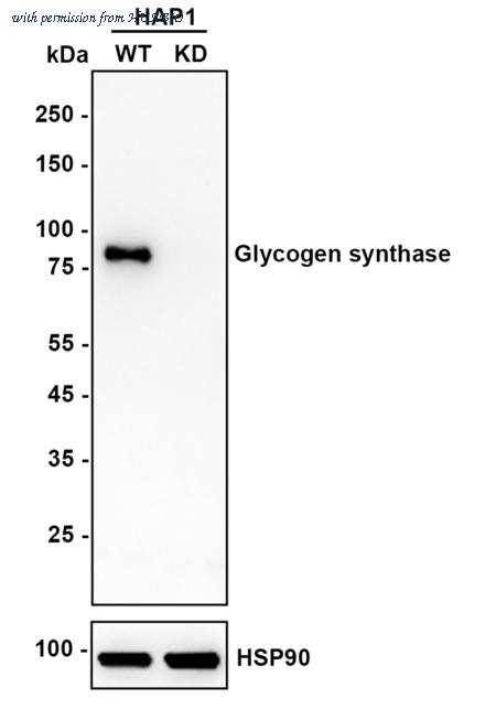 HUABIO ET1611-59 image 1