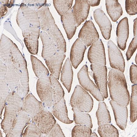 HUABIO ET1611-59 image 3