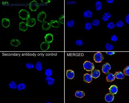 HUABIO ET1611-6 image 2