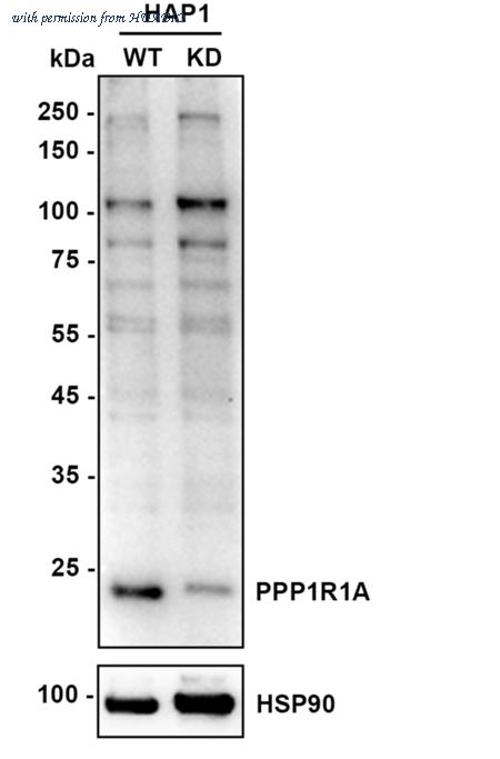 HUABIO ET1611-60 image 2