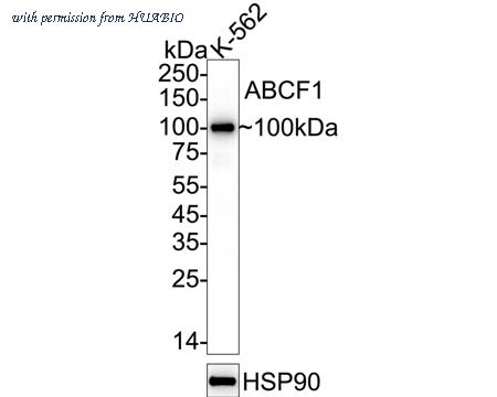 HUABIO ET1611-63 image 1
