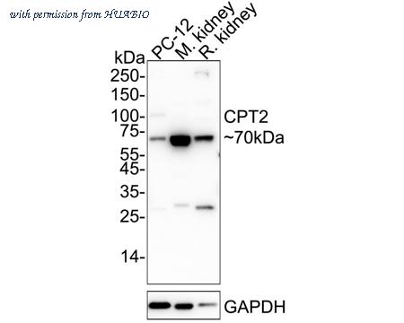 HUABIO ET1611-64 image 1
