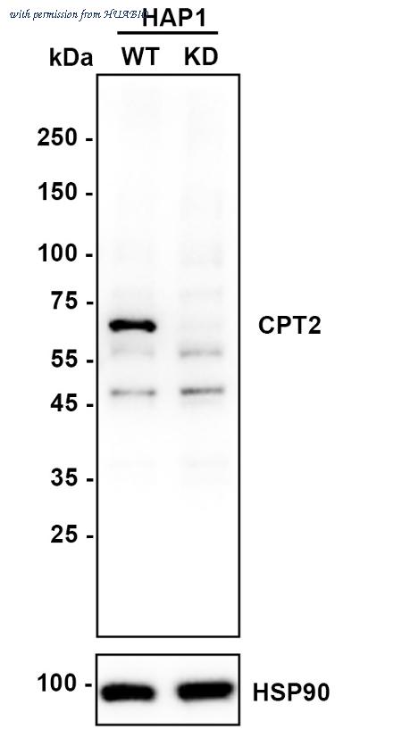 HUABIO ET1611-64 image 2