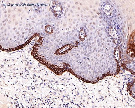 HUABIO ET1611-65-50UL image 3