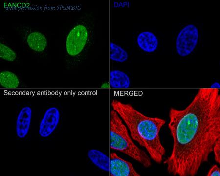 HUABIO ET1611-67 image 2