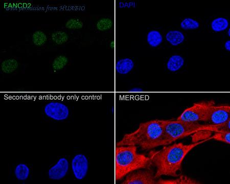 HUABIO ET1611-67 image 3
