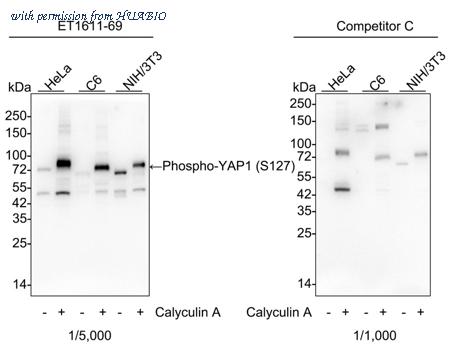 HUABIO ET1611-69 image 1