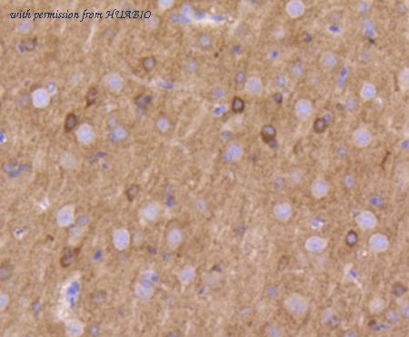 HUABIO ET1611-7 image 2