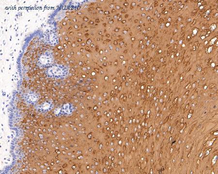 HUABIO ET1611-71 image 3