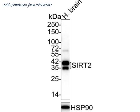 HUABIO ET1611-72 image 1