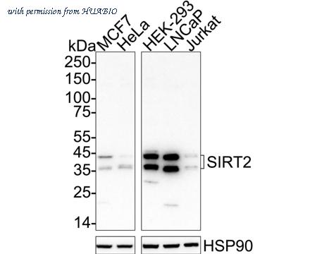 HUABIO ET1611-72 image 2