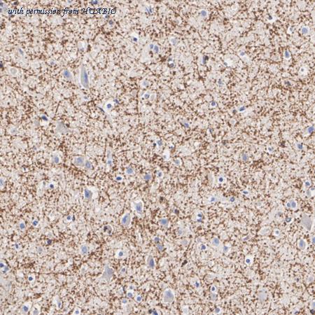 HUABIO ET1611-72 image 3