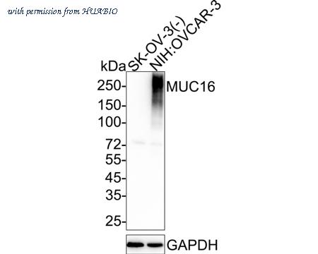 HUABIO ET1611-73 image 1