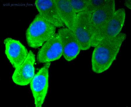 HUABIO ET1611-74 image 2