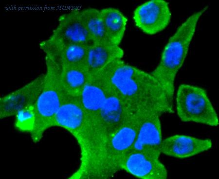 HUABIO ET1611-74 image 3