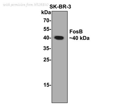 HUABIO ET1611-75 image 1