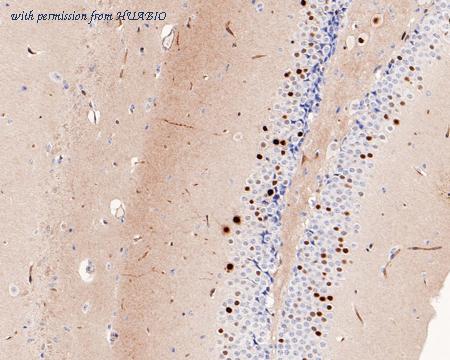 HUABIO ET1611-75 image 3