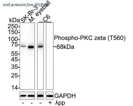 HUABIO ET1611-78 image 1