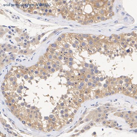 HUABIO ET1611-78 image 2