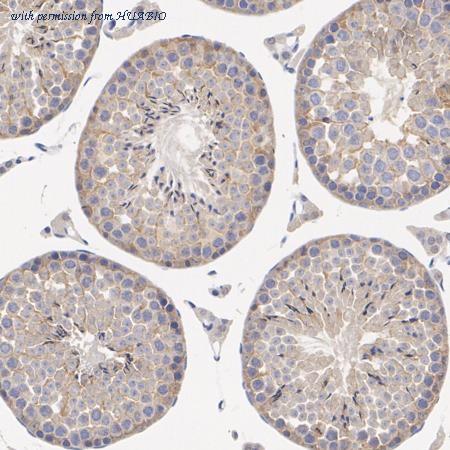 HUABIO ET1611-78 image 3