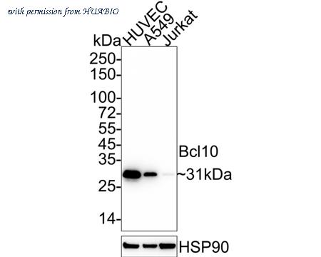 HUABIO ET1611-79 image 1