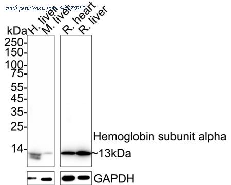 HUABIO ET1611-81 image 1