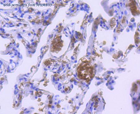 HUABIO ET1611-81 image 2