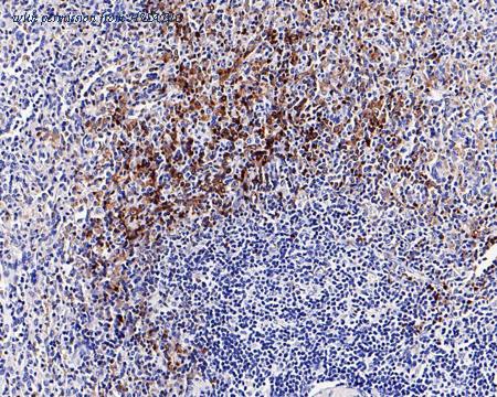 HUABIO ET1611-81 image 3