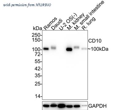 HUABIO ET1611-82 image 1