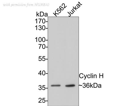 HUABIO ET1611-84 image 1
