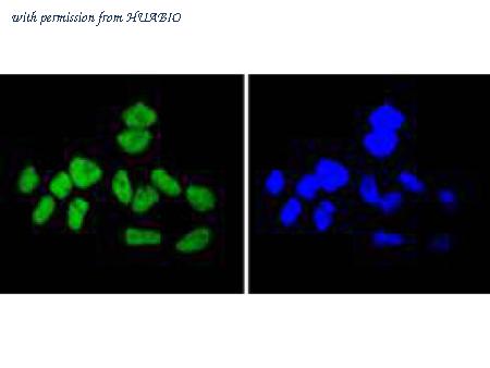 HUABIO ET1611-84 image 2