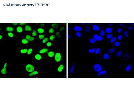 HUABIO ET1611-84 image 3