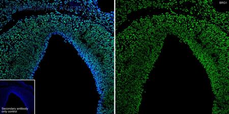 HUABIO ET1611-85-50UL image 3