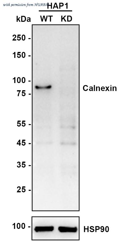HUABIO ET1611-86 image 2