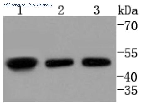 HUABIO ET1611-88 image 1