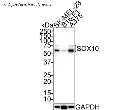 HUABIO ET1611-89 image 1