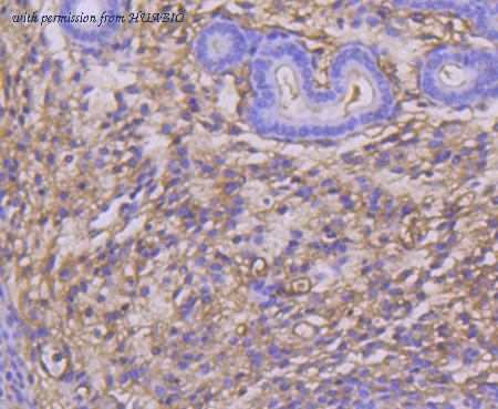 HUABIO ET1611-93 image 1