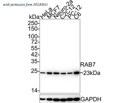 HUABIO ET1611-96-50UL image 1