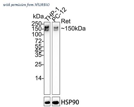 HUABIO ET1611-98-50UL image 1