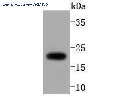 HUABIO ET1612-12 image 2