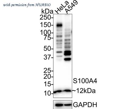 HUABIO ET1612-13-50UL image 1