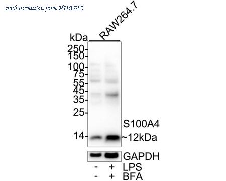 HUABIO ET1612-13-50UL image 2