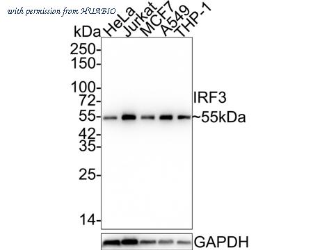 HUABIO ET1612-14-50UL image 1