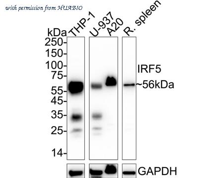 HUABIO ET1612-15 image 1